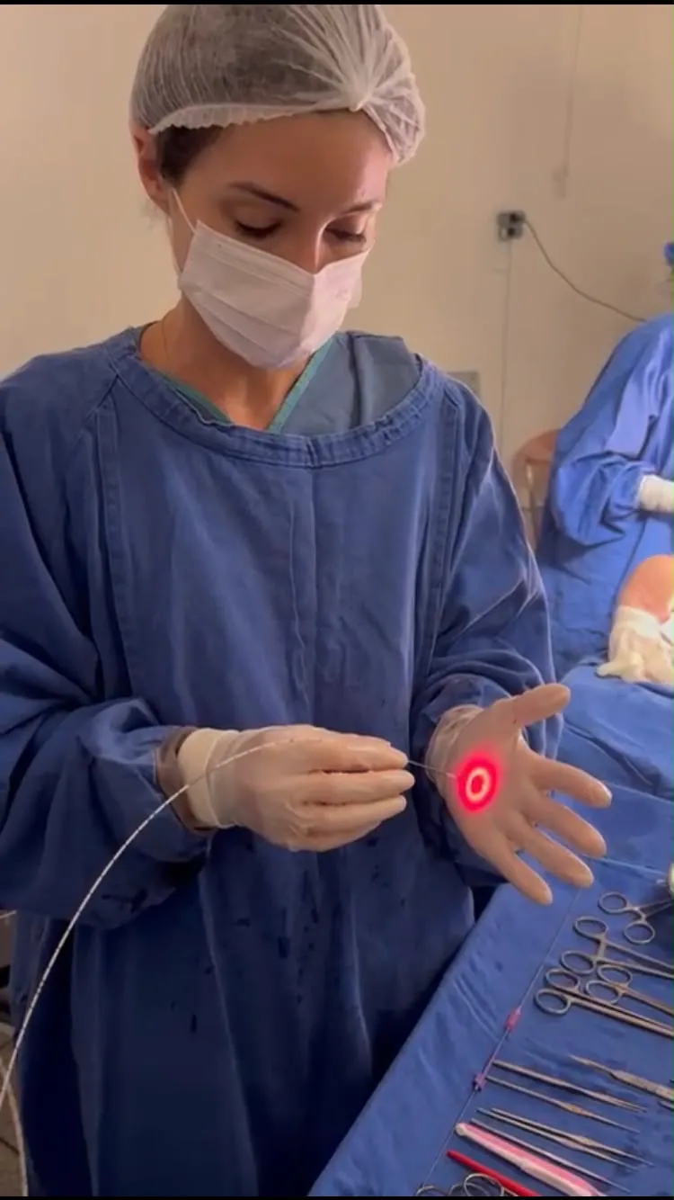 Cirurgiã vascular em traje cirúrgico segurando a fibra de laser endovenoso com luz vermelha na ponta