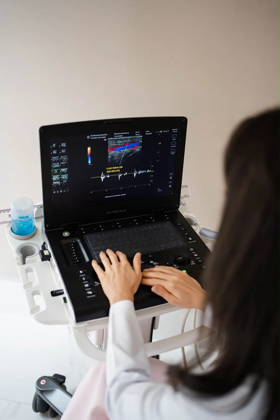 Profissional realizando ecodoppler venoso com transdutor sobre a perna e mapeamento do fluxo na tela do aparelho