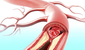Dra. Giovanna Guarinello Tratamentos e Cirurgia Vascular | Dra. Giovanna Guarinello